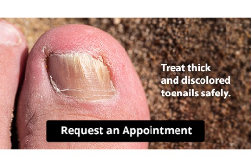 Stop Your Toenail Fungus