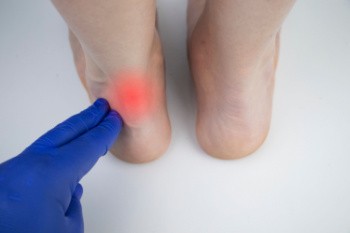 Causes and Risk Factors of Achilles Tendon Injuries