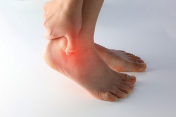 Symptoms and Risk Factors for Ankle Gout